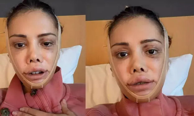 Didem Ceran Ameliyat Sonrası Son Halini Paylaştı