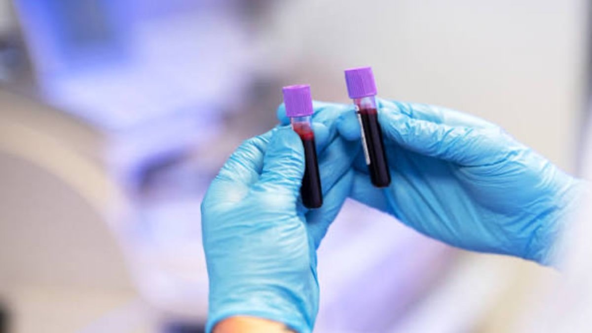 Vazopressin nedir, nasıl yükselir? Erkeklerde "vazopressin" hormonu